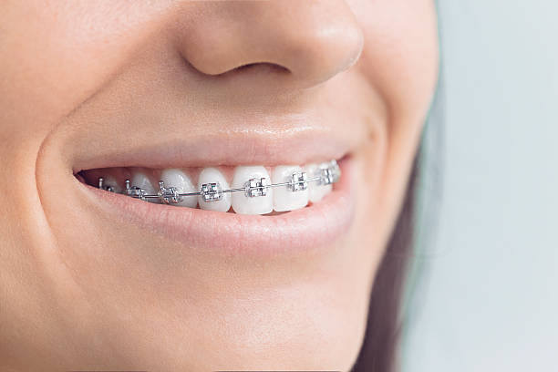 Best Invisalign and Clear Aligners  in Washington, MO